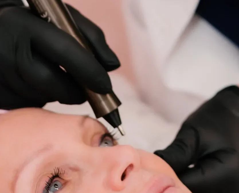 Why Plasma Pen Therapy Is the New Anti-Aging Trend